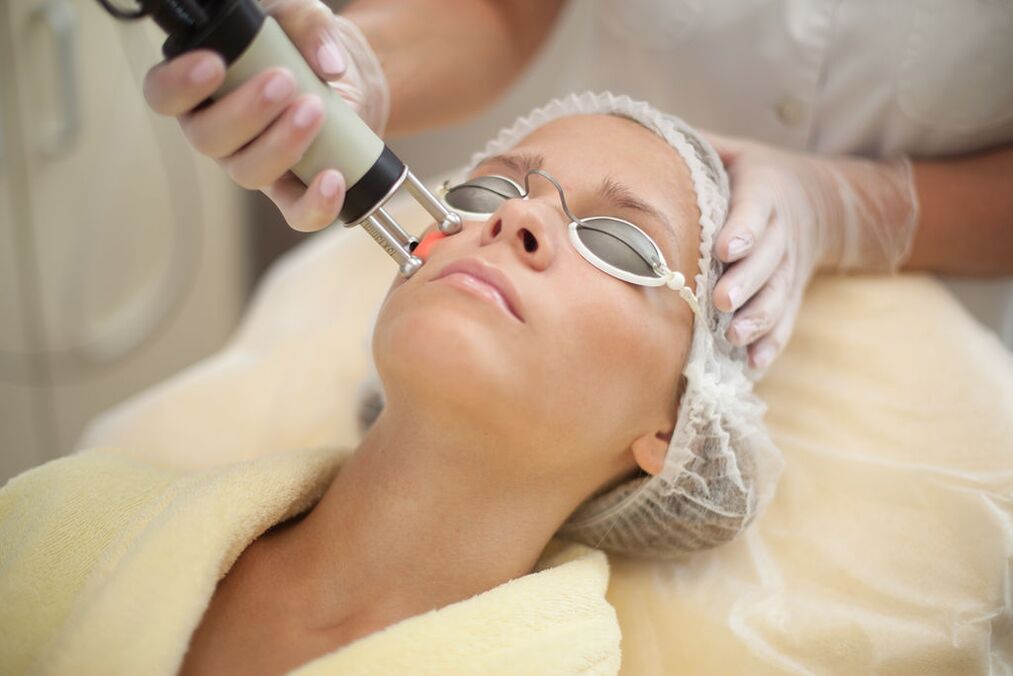 Laser Rejuvenation ng balat