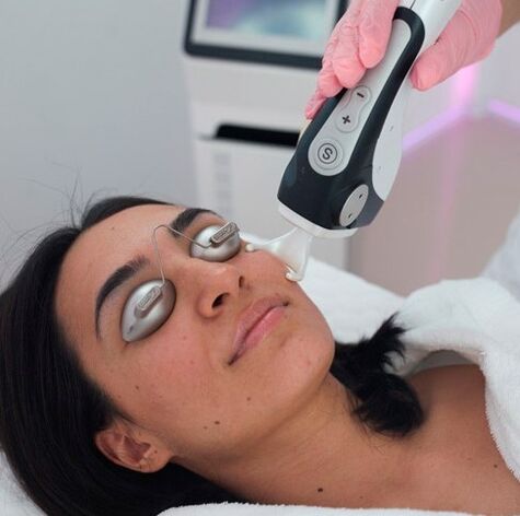 Apat ang mga pigment spot