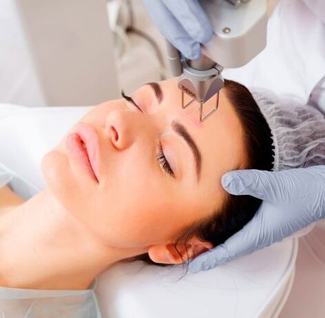 Laser Rejuvenation ng Mukha