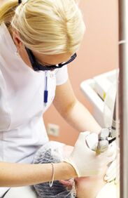 Ang isang doktor ay nagsasagawa ng isang pamamaraan ng photothermolysis