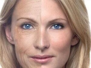 Pigmentation ng balat